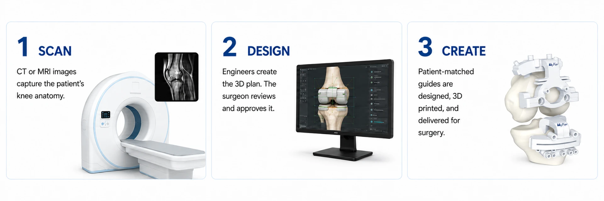 Three MyKnee planning steps: scan the knee, design the 3D plan, and create patient-matched guides