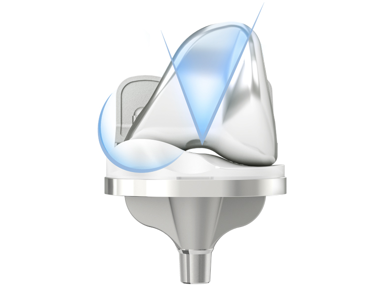 Close view of the Sphere knee implant's curved ball-in-socket design
